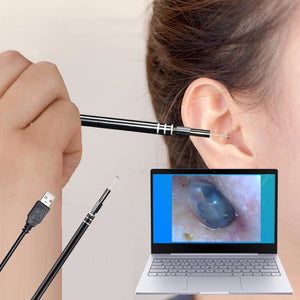 In-ear Cleaning Endoscope - Pc And Android Devices